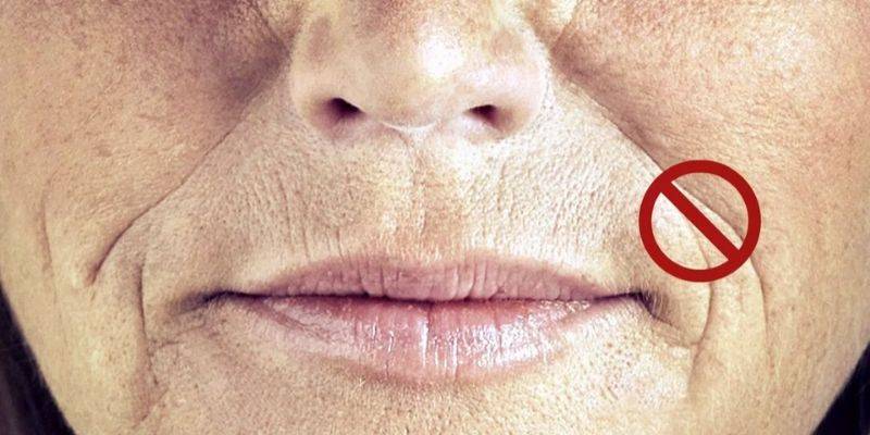 Морщины вокруг рта: как от них избавиться