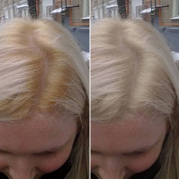 Что нанести на волосы после окрашивания. можно ли после осветления сразу красить волосы: влияние осветления на структуру волос, период между осветлением и окрашиванием. сравнение ollin и kaaral baco