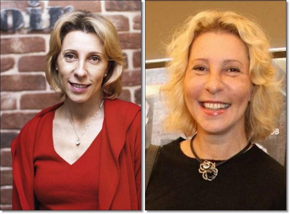 Как изменились лица российских звёзд до и после пластических операций