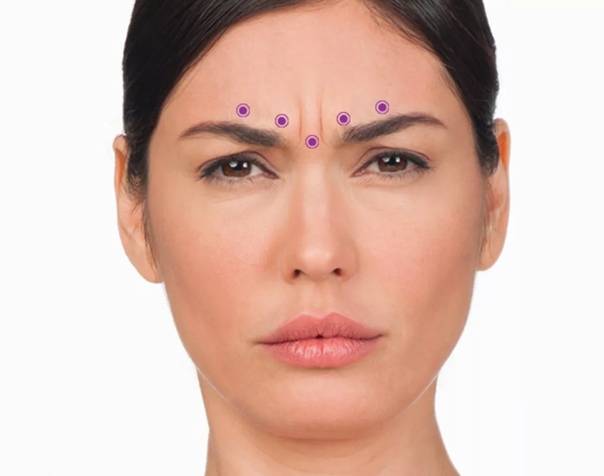 Как убрать носогубные складки в домашних условиях и в салоне красоты: лучшие методы