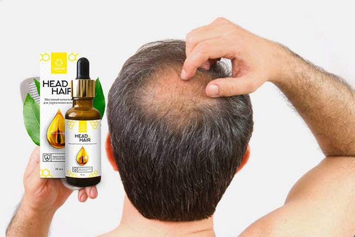 Какие витамины от выпадения волос у мужчин предпочесть – выбираем лучшие