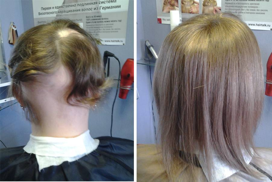 Как обладать длинной густой косой: наращивание на короткие волосы, фото до и после?