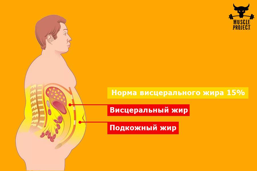 Как избавиться от висцерального жира у мужчин. Подкожный и висцеральный жир. Подкожный, висцеральный жир на животе. Ожирение внутренних органов.
