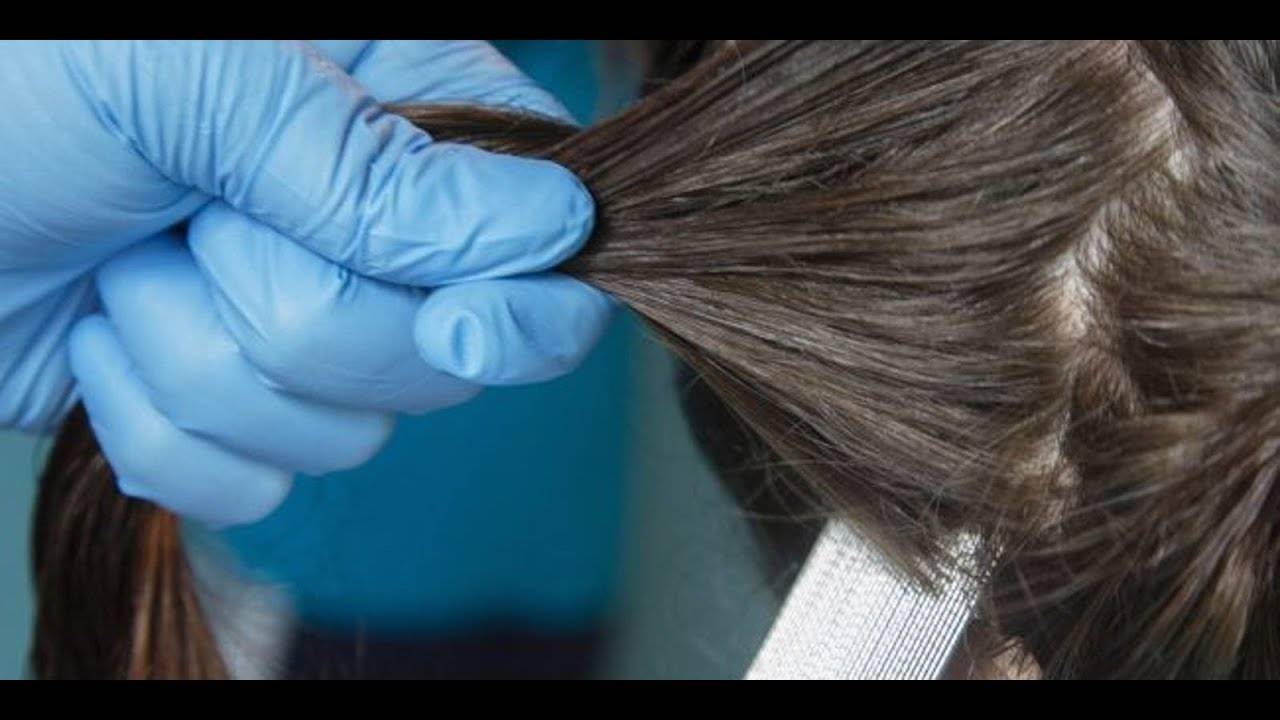 На педикулез осматриваются. Стрижка волос при педикулезе. Осмотр волосистой части головы.