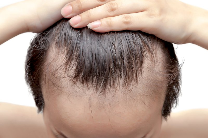 Почему жесткие волосы у ребенка