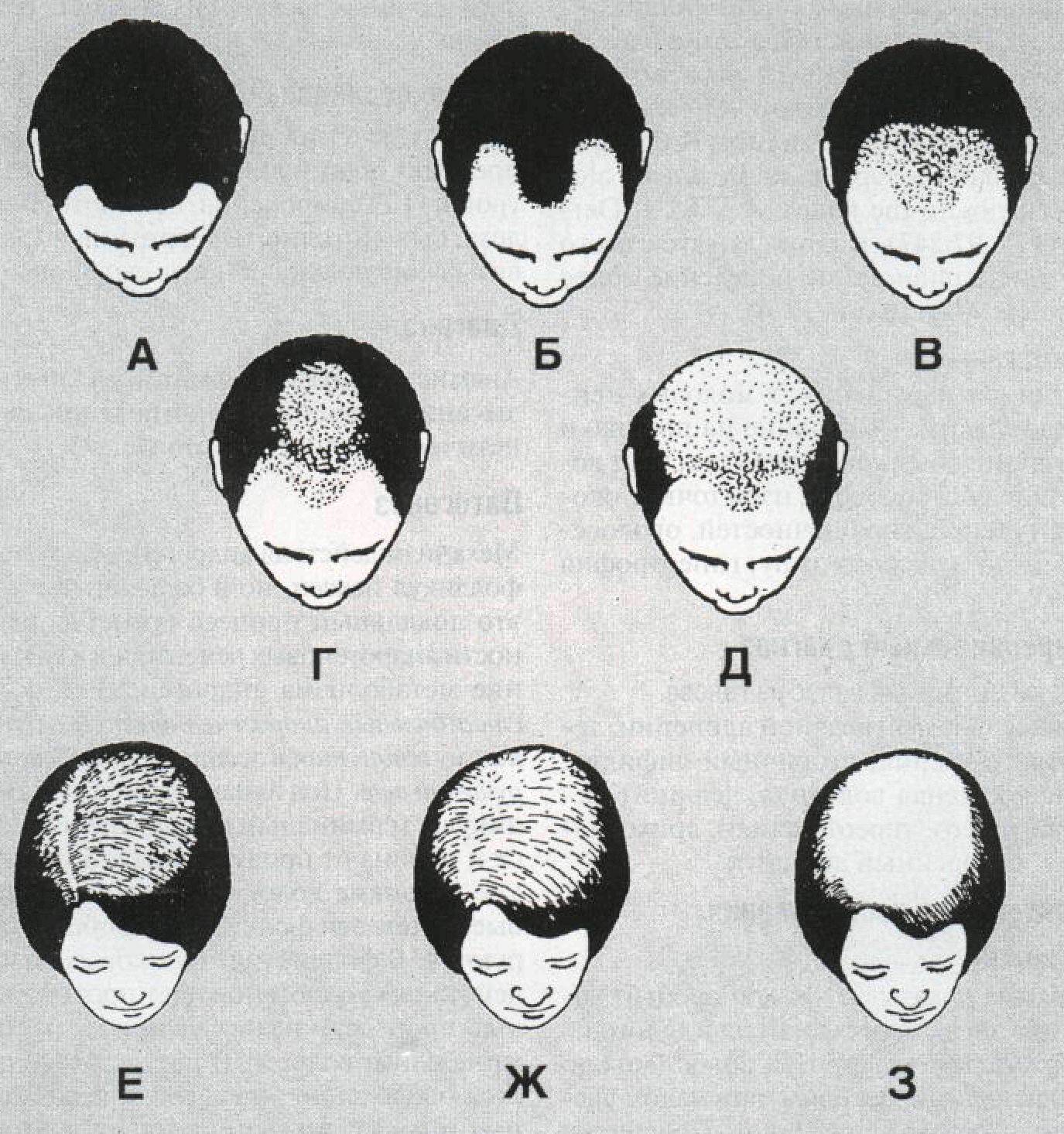 Округлая форма головы