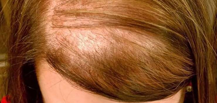 Беременность;выпадение волос; как ухаживать за волосами