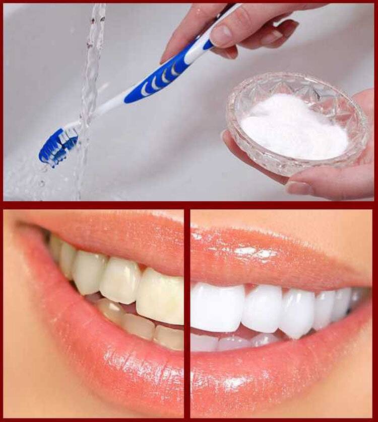 Зуб отбеливание пить. Эмаль для отбеливания зубов. Отбеливание зубов содой и зубной пастой. Отбеливание зубов содой. Домашняя зубная паста для отбеливания зубов.