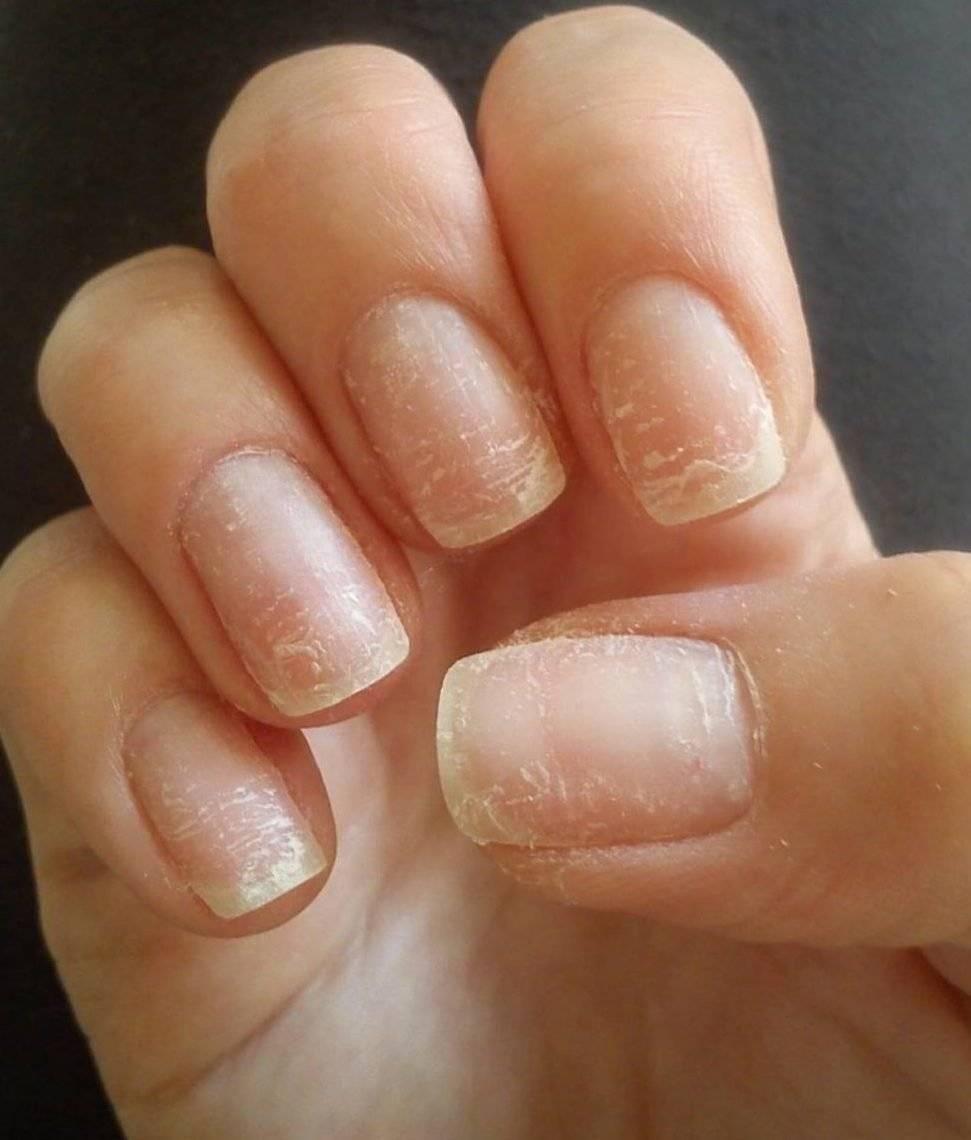 Кто виноват и почему нарощенные ногти отслаиваются?