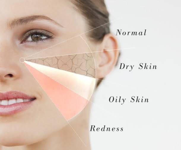 Тип кожи drnw: сухая, устойчивая к раздражению, непигментированная, склонная к появлению морщин.