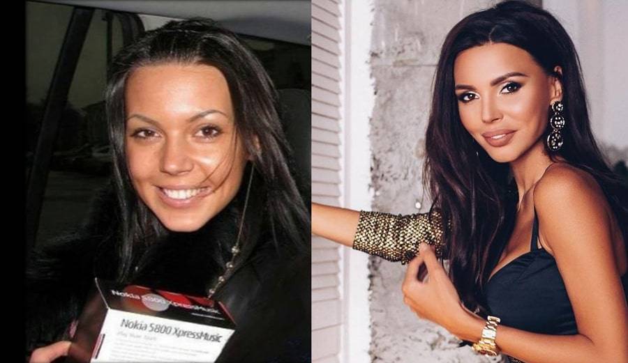 Оксана самойлова до и после пластических операций, фото и видео
оксана самойлова: легко ли быть подружкой рэпера? – womanmirror