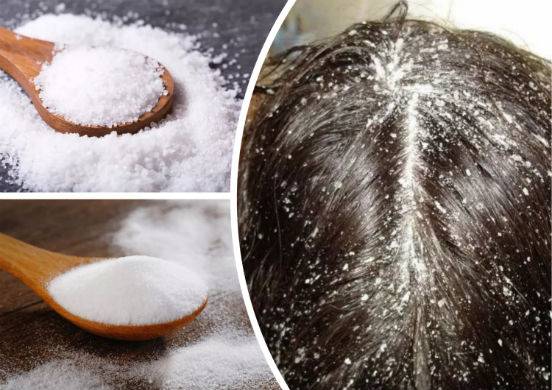 Будет ли польза если добавить соль в шампунь для волос?