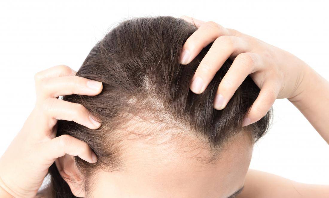 Сезонное выпадение волос осенью, зимой, весной и летом: причины и как предотвратить