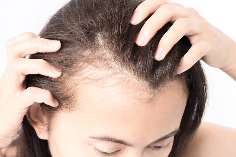 Выпадение волос: что считается нормой и когда стоит беспокоиться. средство от выпадения волос