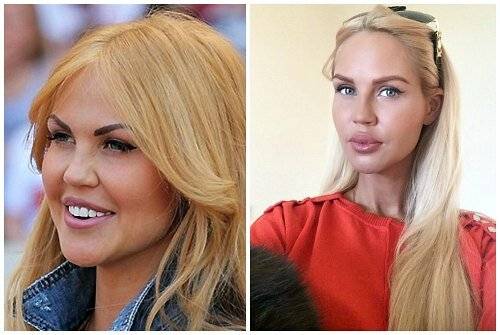 О том, как выглядит мария погребняк до и после пластики губ. были ли другие пластические операции? :: syl.ru