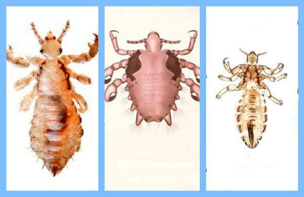 ❶ вши на волосах: как выглядят взрослые особи и их яйца на голове у человека