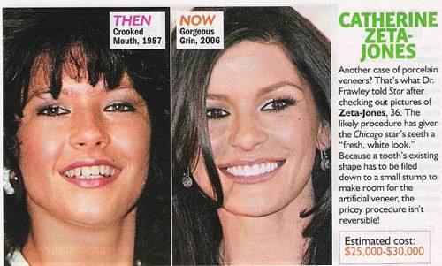 Звезды без макияжа: фото до и после без фотошопа, россия, голливуд - 24сми