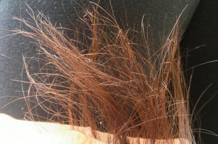 Основные причины сухих волос и кожи головы: почему это бывает и как предотвратить?