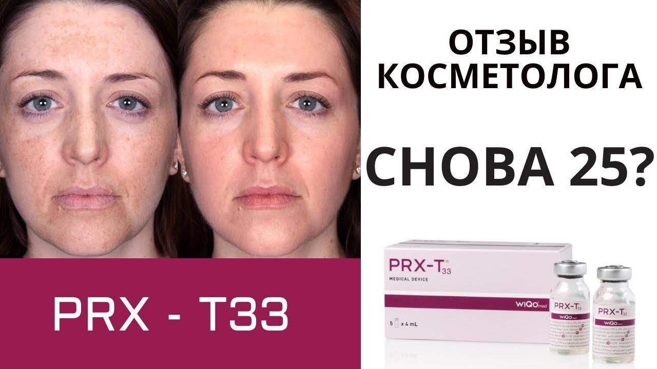 Восстановление кожи без уколов пилингом prx-t33