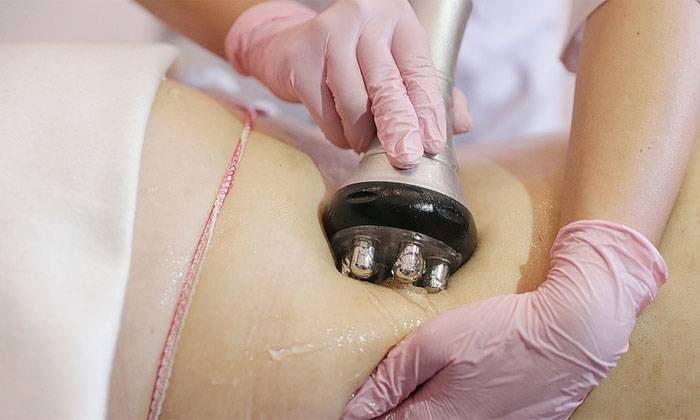 Ультразвуковая кавитация – что это такое и как ее проводят?