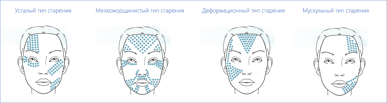 Как правильно колоть липолитики схема