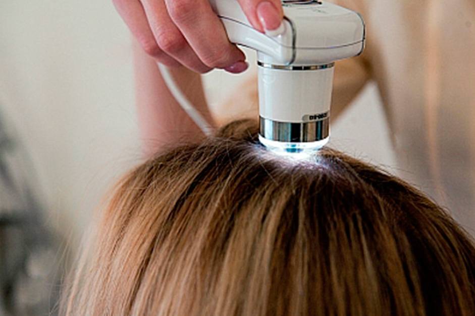 Фракционная мезотерапия кожи головы, а также классический и безинъекционный методы для волос: особенности проведения каждой процедуры и сравнение эффективности