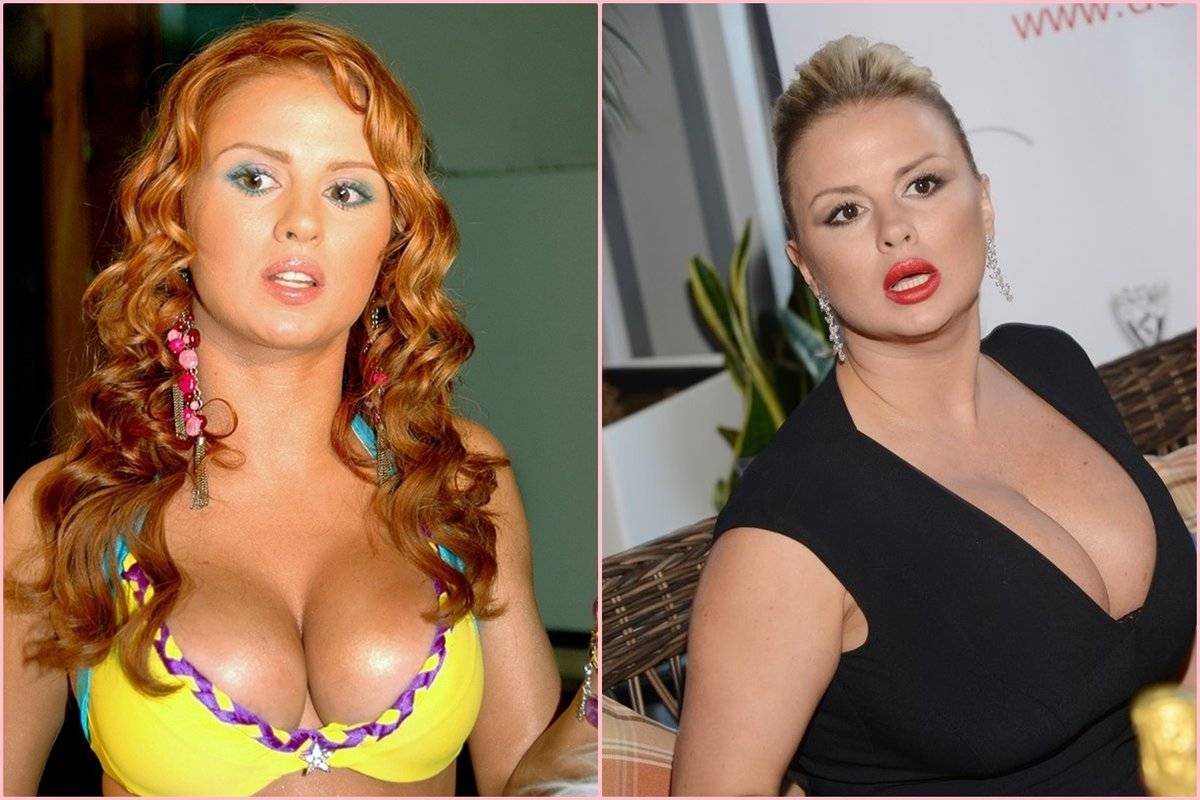 Звезды после неудачной пластики – фото российских знаменитостей до и после пластических операций