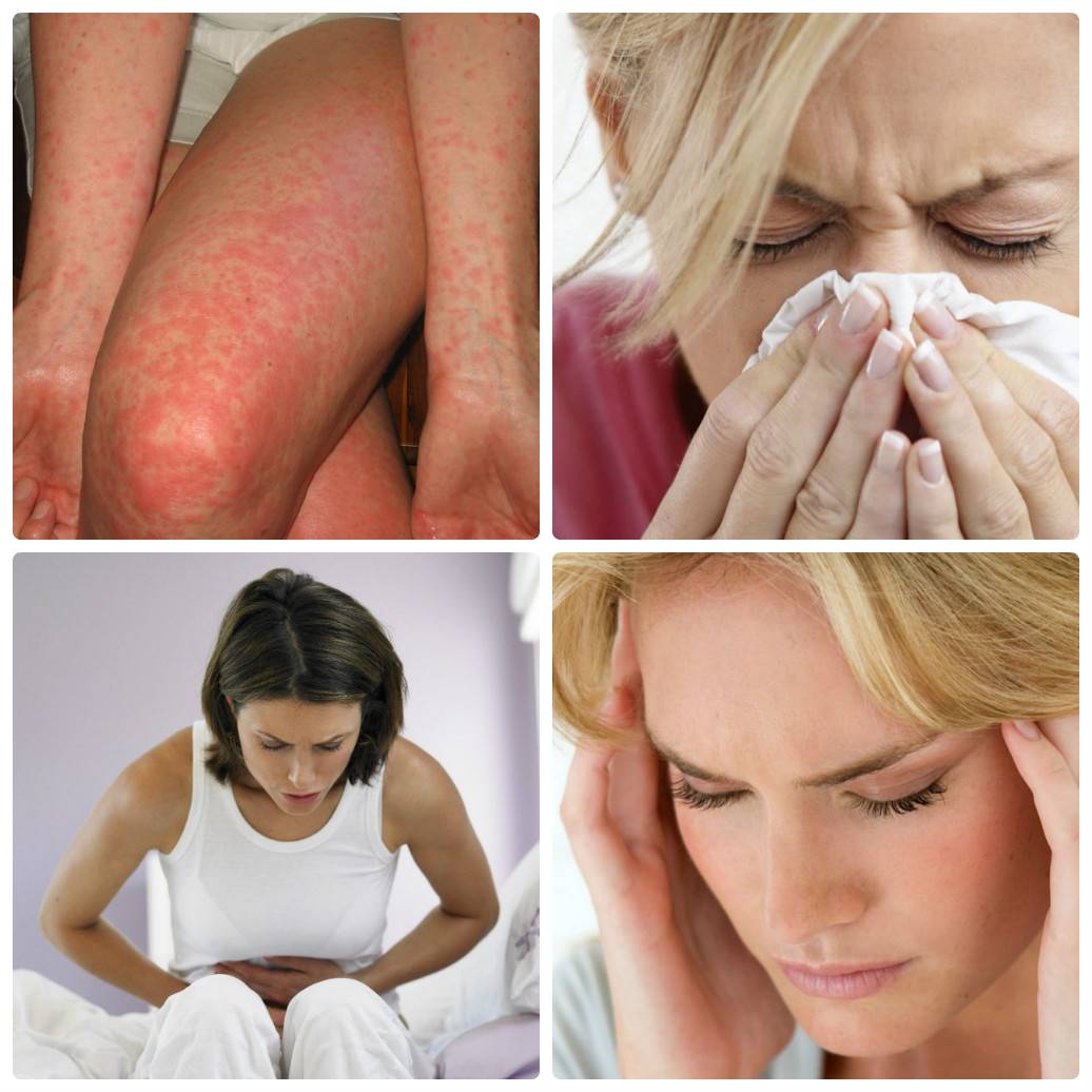 Зуд после беременности. Кожные аллергические реакции. Аллергическая реакция на коже.