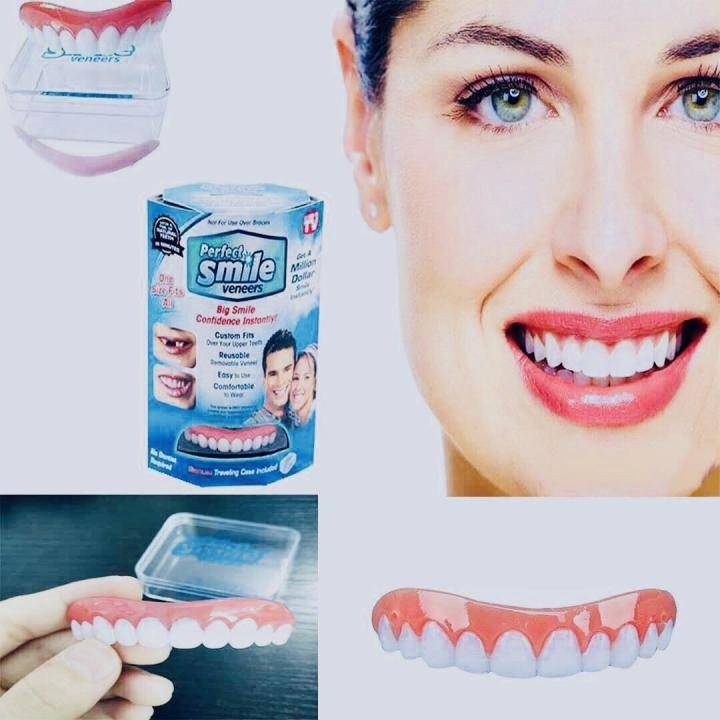 Виниры perfect smile veneers: реальные отзывы, стоимость