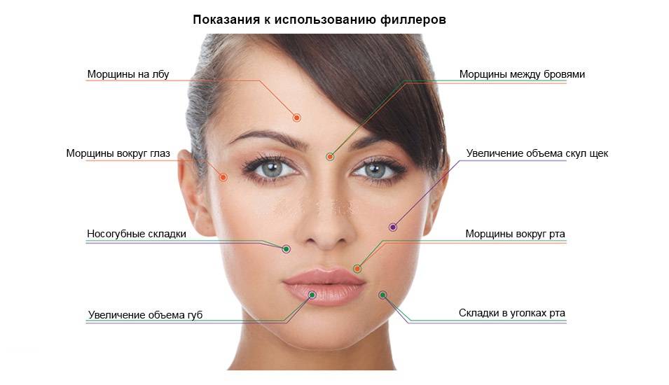 Как убрать носогубные складки