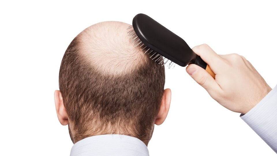 10 причин выпадения волос: советы и рекомендации